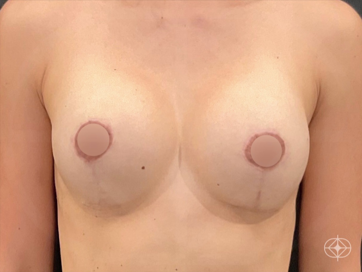 Pós
