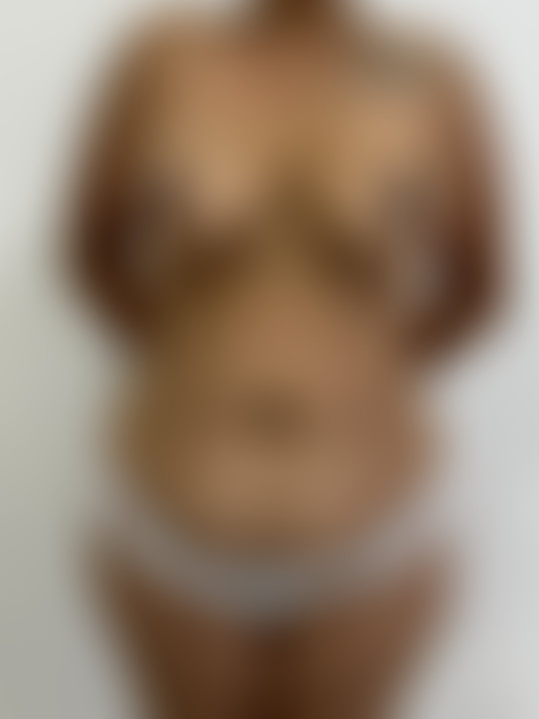 Foto antes de Mastopexia sem Prótese realizado por Dr. João Ferreira