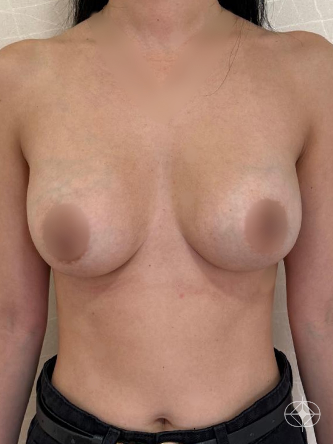 Pós