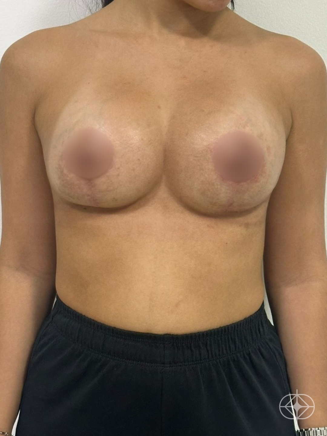 Pós