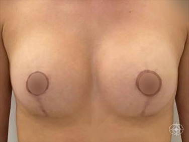 Pós