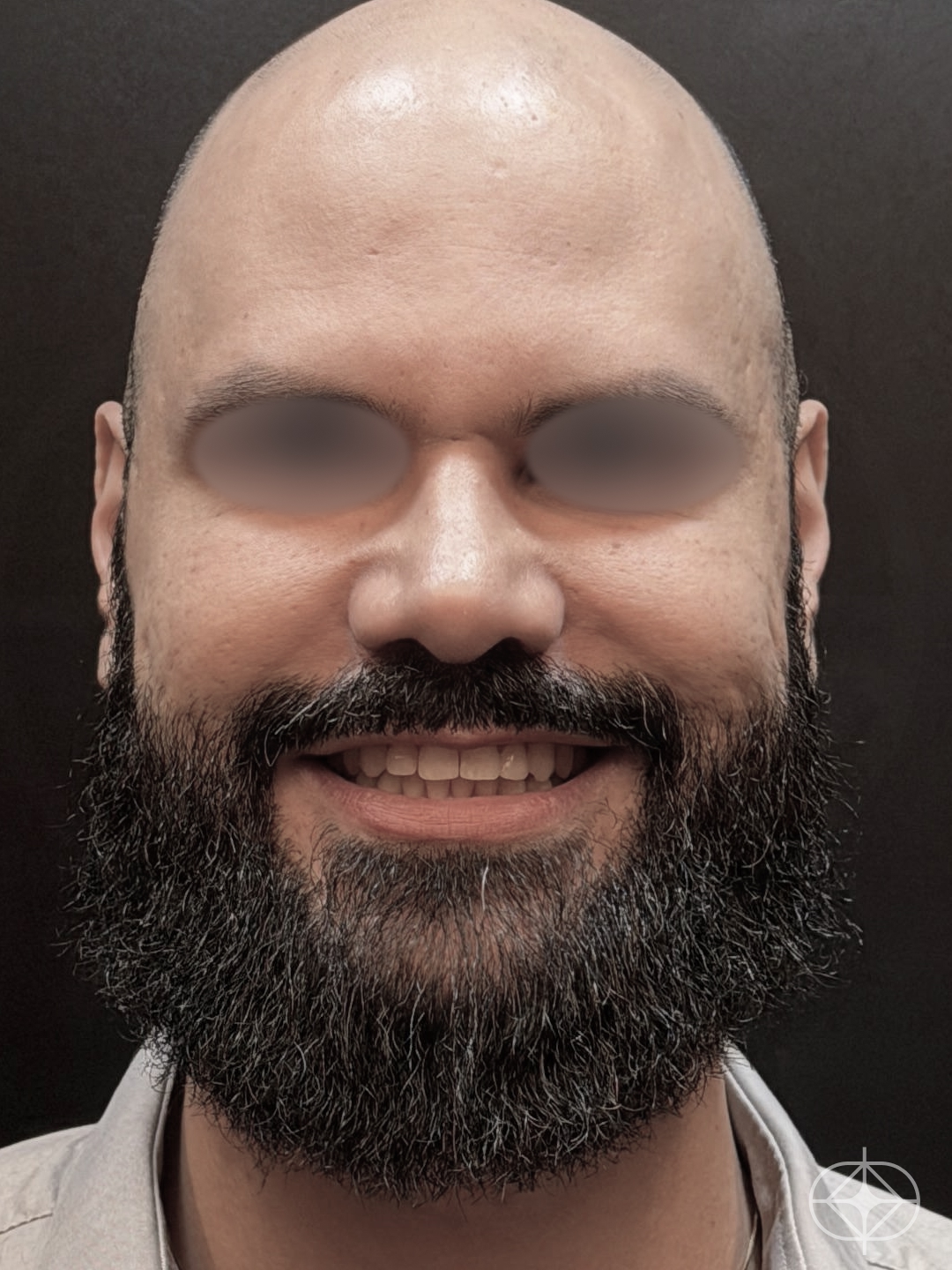 Pós