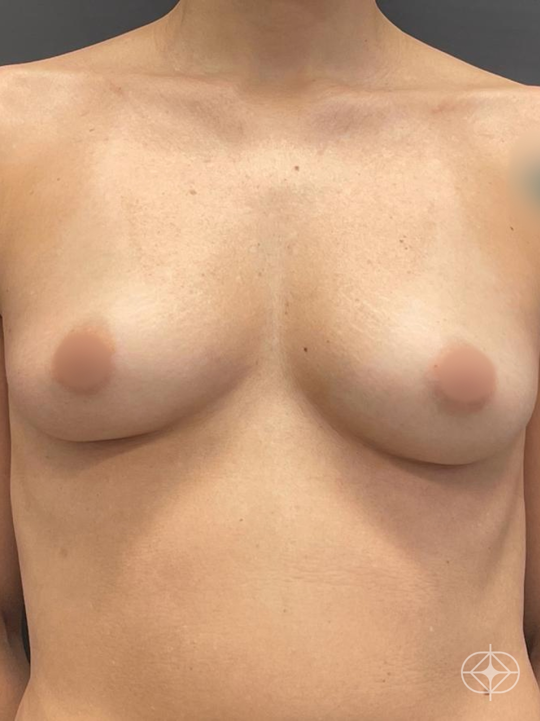 Pré