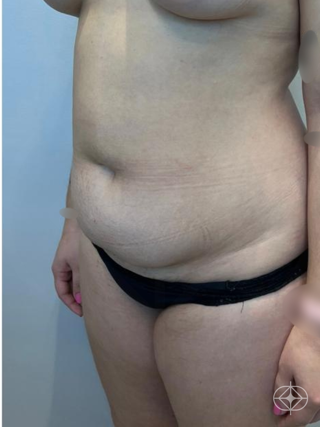 Pré