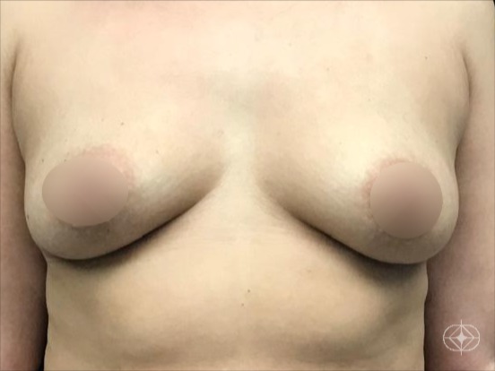 Pré