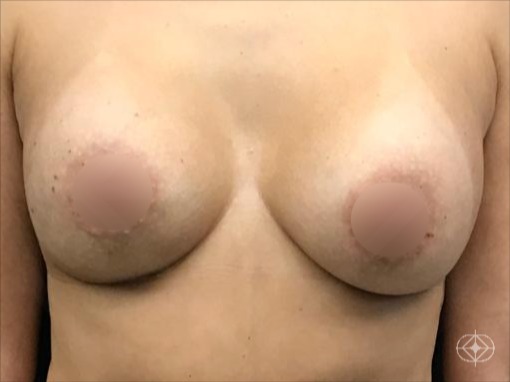 Pós