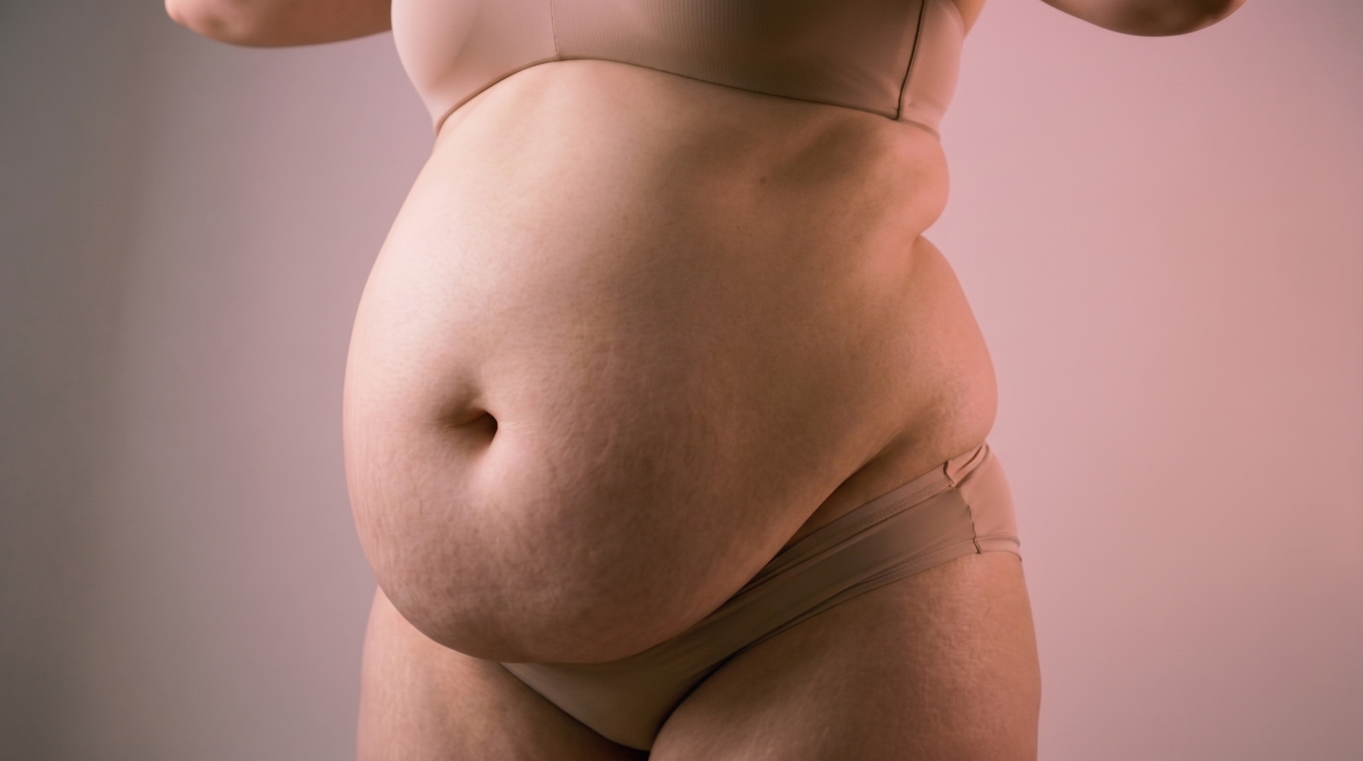 Cirurgia Bariátrica (obesidade)